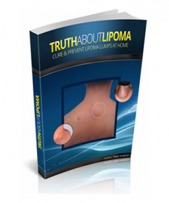 Cure Lipoma Lumps