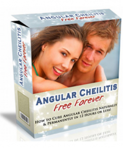 Angular cheilitis free