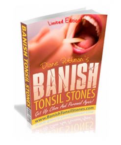 Banish tonsil stones VSL