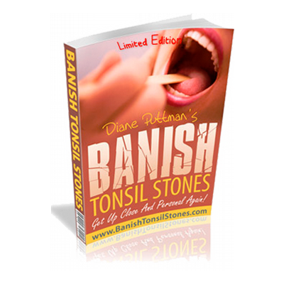 Banish tonsil stones VSL
