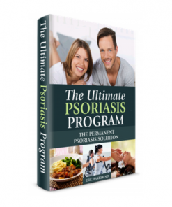 Psoriasis free for life